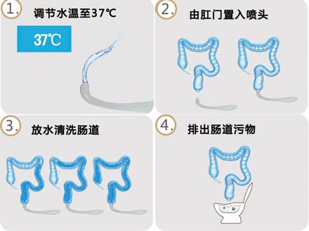 洗肠过程