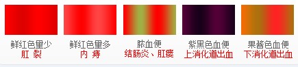 大便出血是什么原因?点击快速咨询