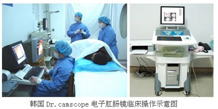电子肛肠镜检查.jpg